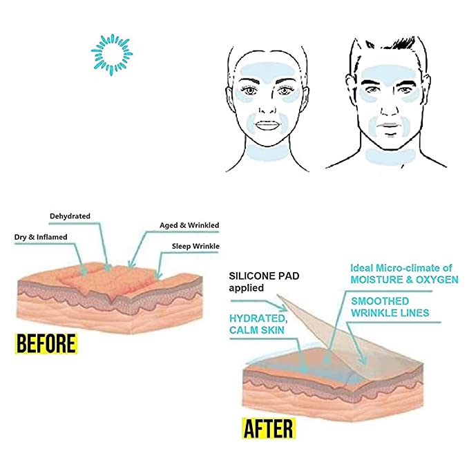 Silicone wrinkle patches (16 pcs) - Lavoca